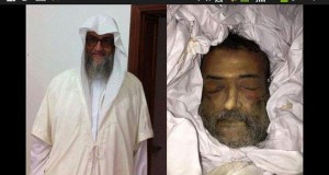 شاهد: آثار التعذيب بادية على جثمان المجاهد أبو أنس الليبي الذي ادعت امريكا وفاته بالسجن