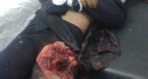 صورة “الطفلة أحلام” التي قتلتها طائرة إسرائيلية بدون طيار يوم أمس ببلدة الماسورة برفح